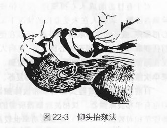 仰头抬颏法
