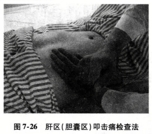 肝区(胆囊区)叩击痛检查法