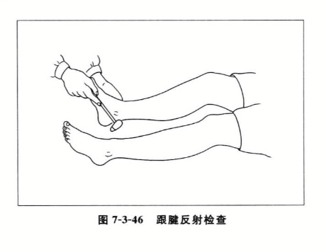 跟腱反射检查