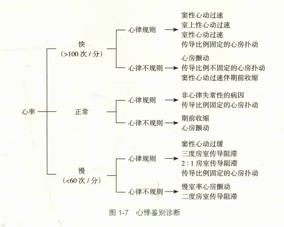 心悸鉴别诊断
