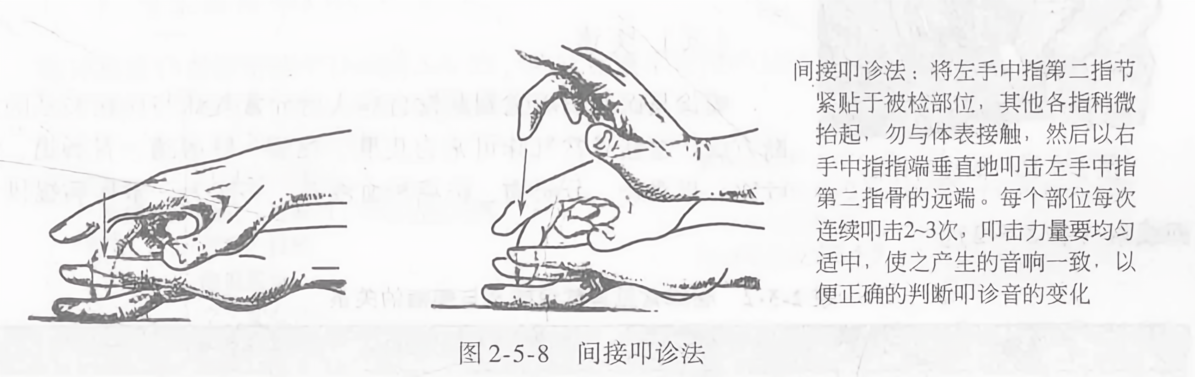 间接叩诊法