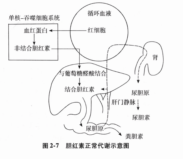 胆红素正常代谢示意图