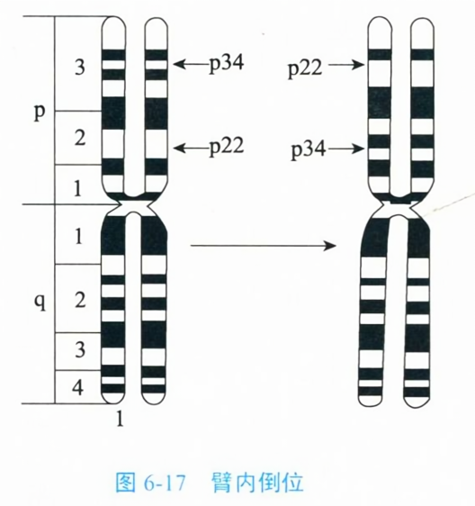 臂内倒位