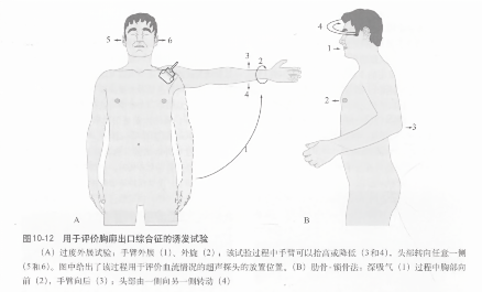 用于评价胸廓出口综合征的诱发试验