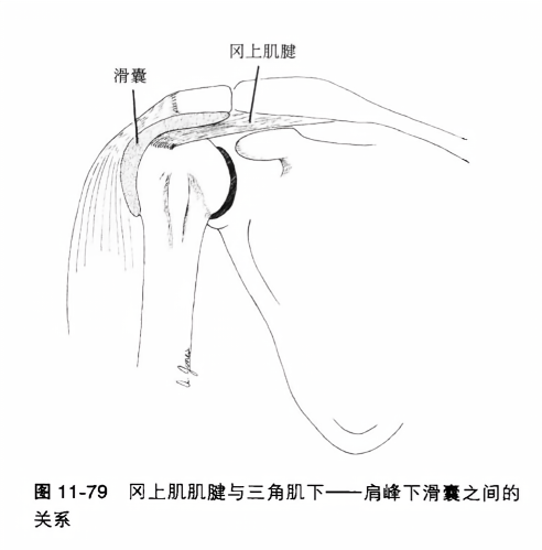 冈上肌肌腱与三角肌下--肩峰下滑囊之间的关系