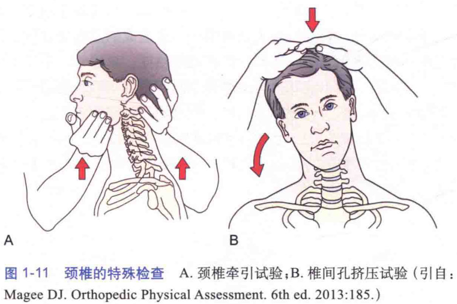 图1-11 颈椎的特殊检查 a. 颈椎牵引试验;b.椎间孔挤压试验(引自: magee dj. or