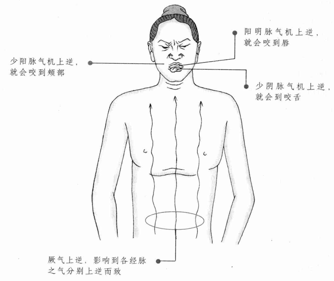 厥气上逆,影响到各经脉之气分别上逆而致
