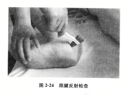 跟腱反射检查