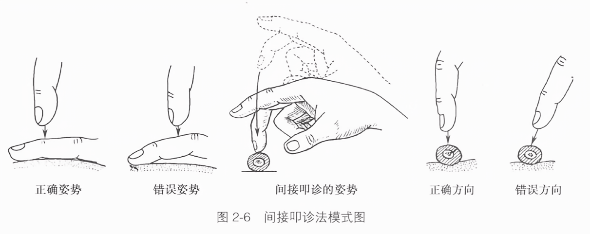 间接叩诊法模式图