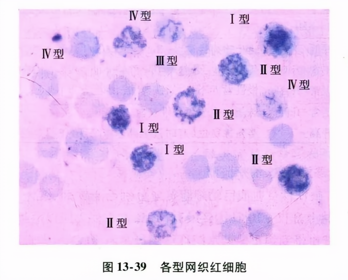 各型网织红细胞