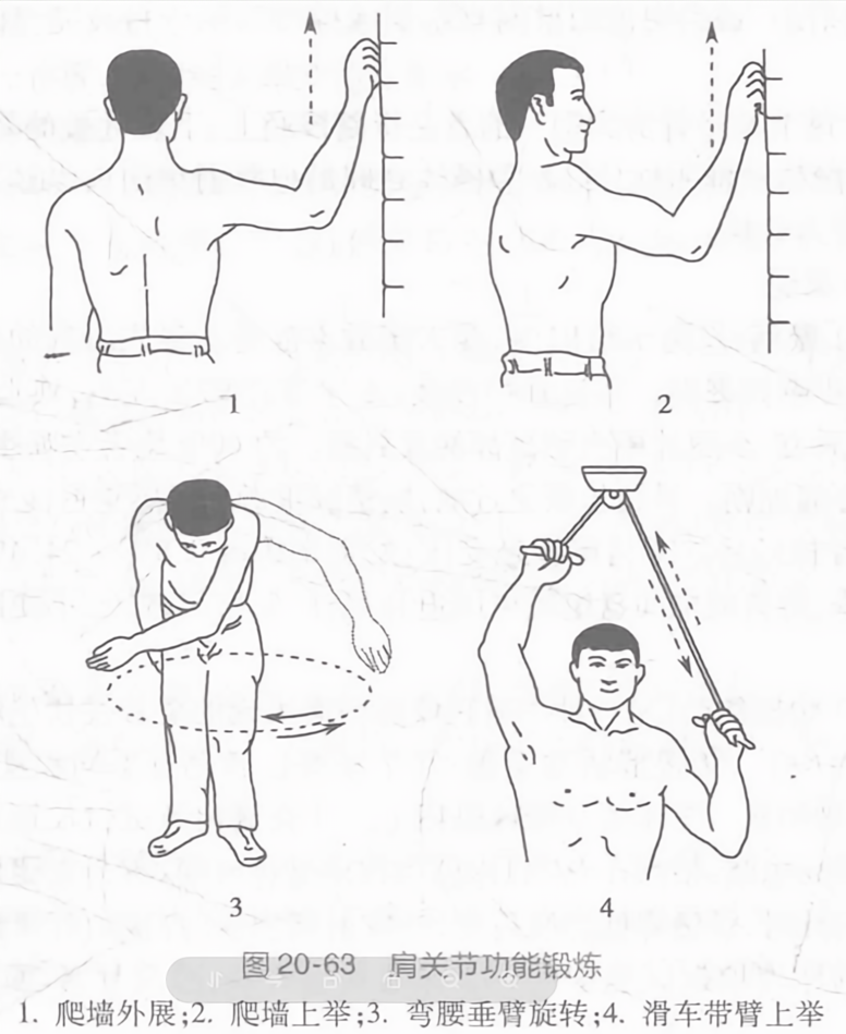 肩关节功能锻炼
