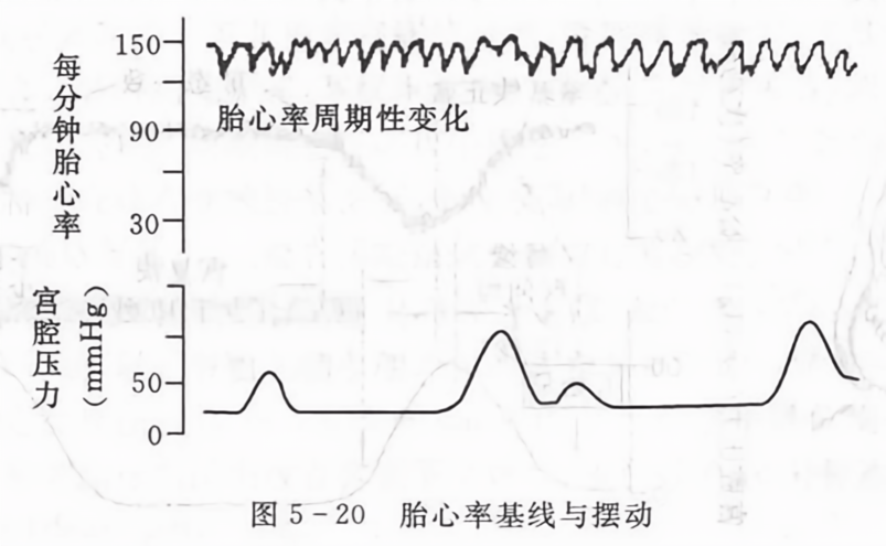 胎心率基线与摆动