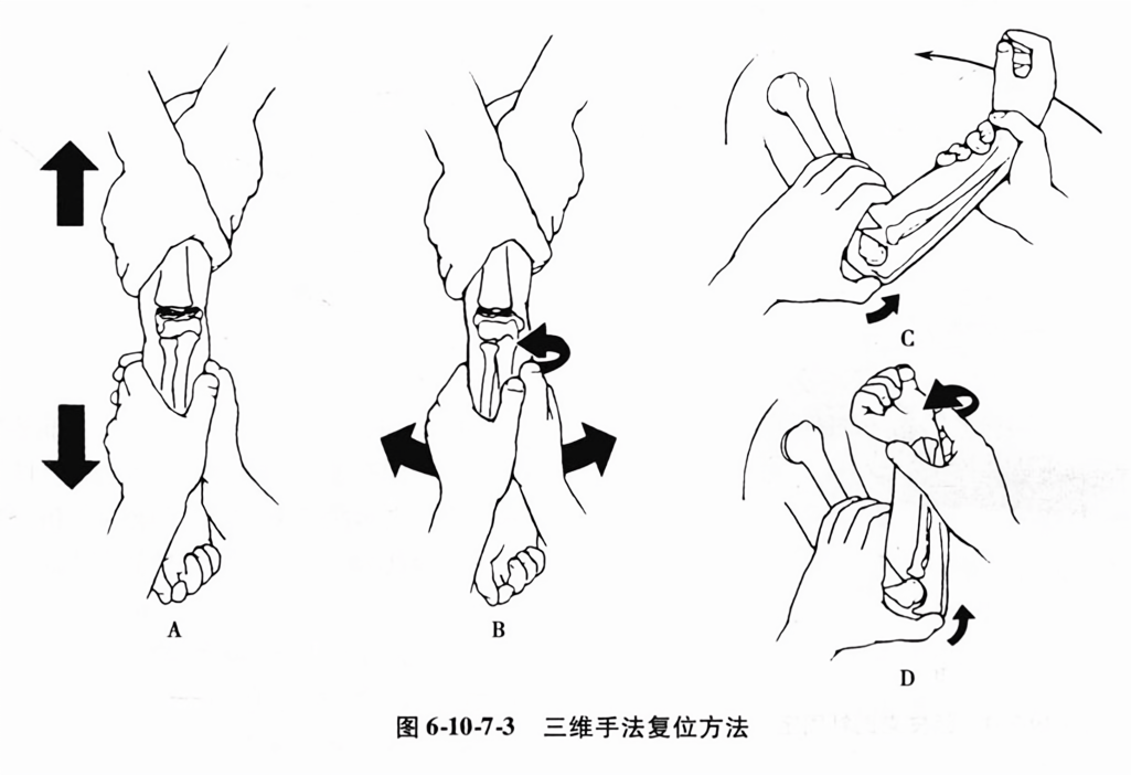 三维手法复位方法