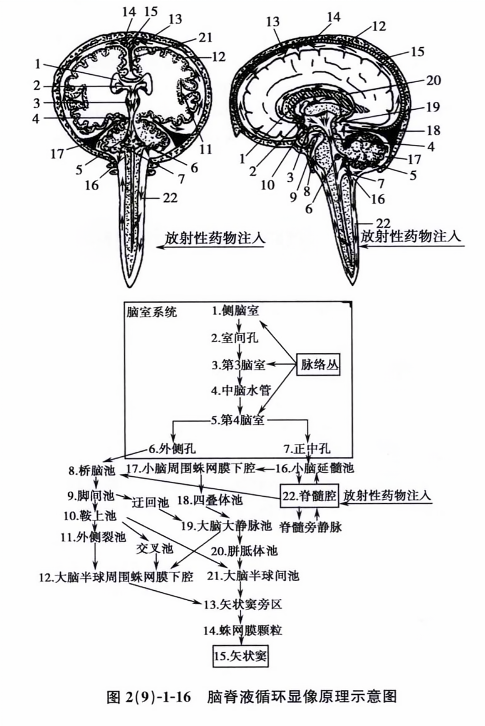 脑脊液循环显像原理示意图