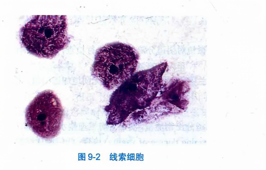 线索细胞