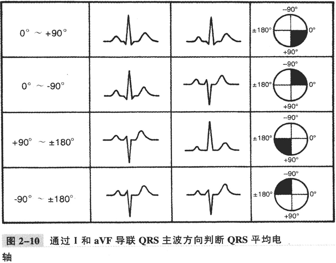 图2-10 通过i和avf导联 qrs 主波方向判断 qrs 平均电轴