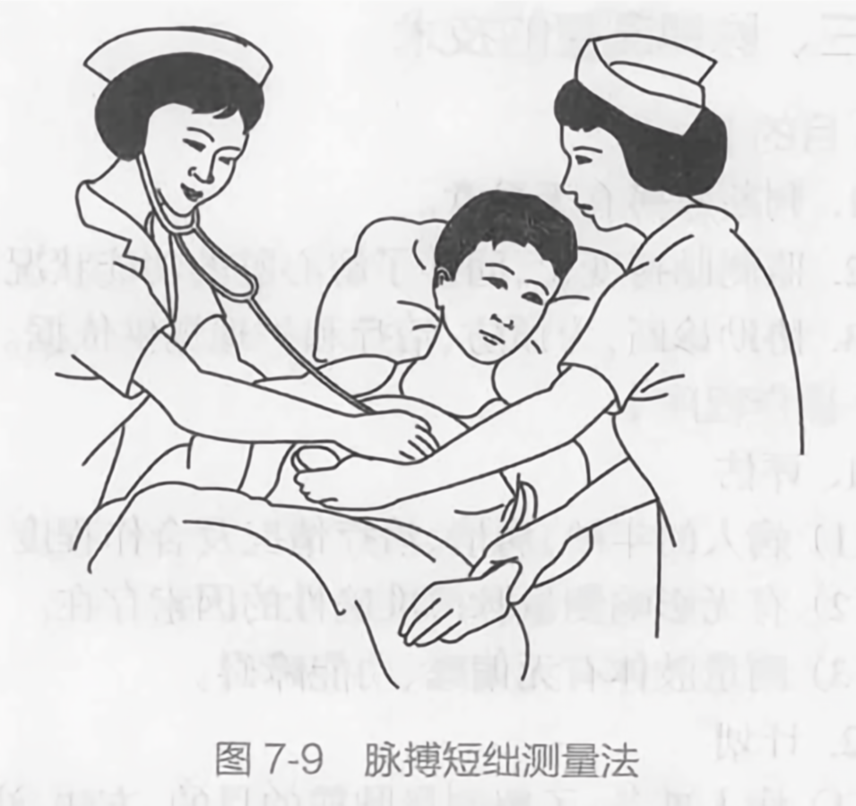 脉搏短绌测量法