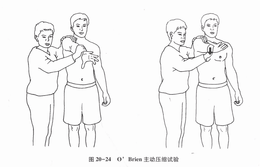 o’brien主动压缩试验