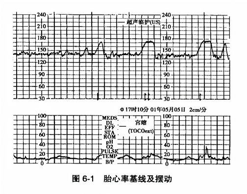 胎心率基线及摆动