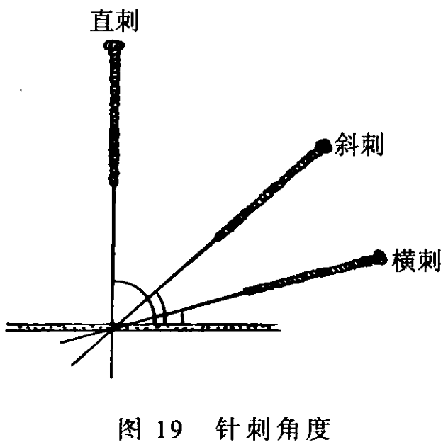图19 针刺角度