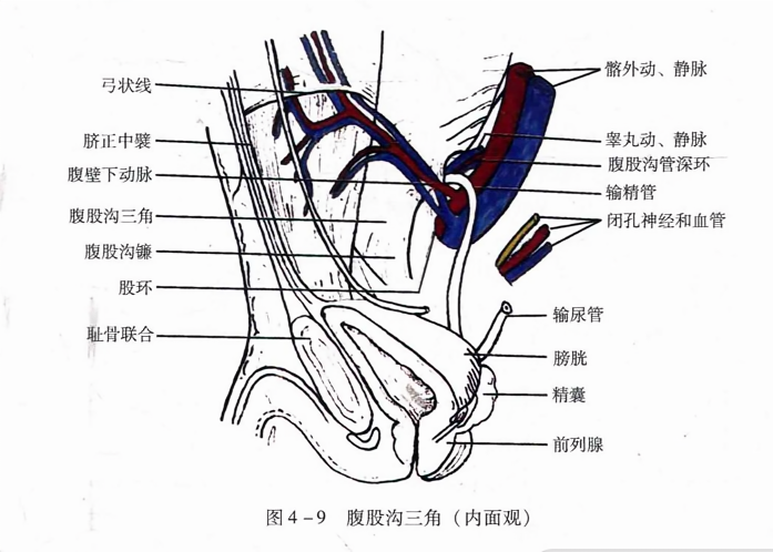 腹股沟三角(内面观)
