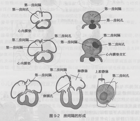 房间隔的形成
