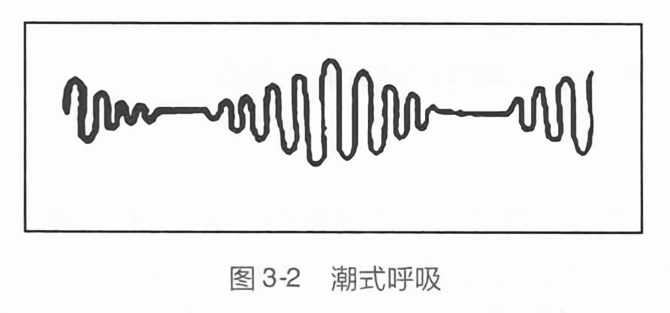 潮式呼吸