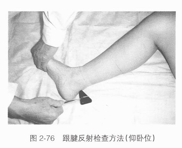 跟腱反射检查方法(仰卧位)