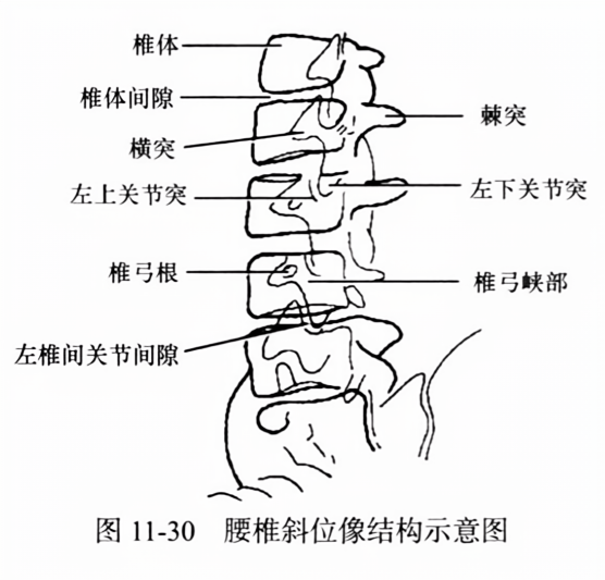腰椎斜位像结构示意图