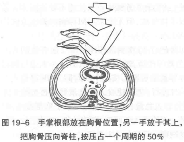 图19-6 手掌根部放在胸骨位置,另一手放于其上, 把胸骨压向脊柱,按压占一个周期的50%