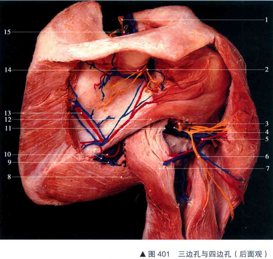图401 三边孔与四边孔(后面观)