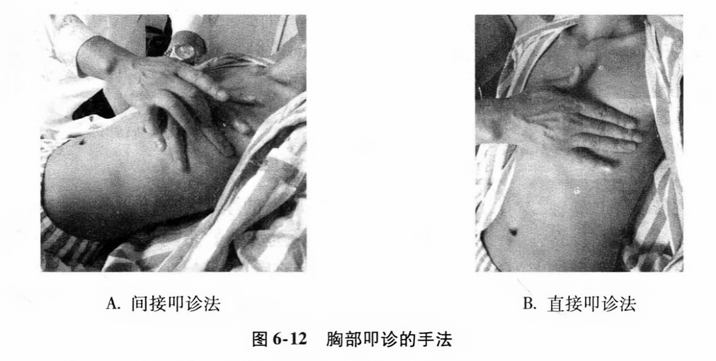 胸部叩诊的手法