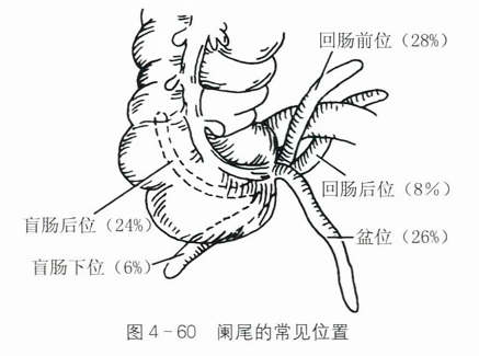 阑尾的常见位置