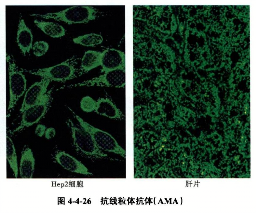 抗线粒体抗体(ama)