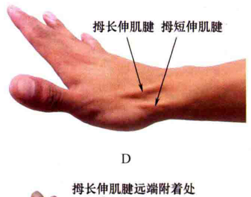 拇长伸肌腱远端附着处