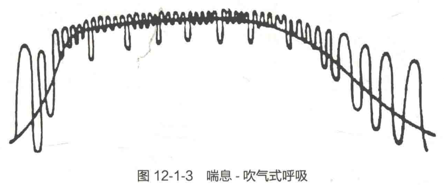 图12-1-3 喘息- 吹气式呼吸