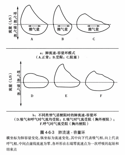 肺流速-容量环
