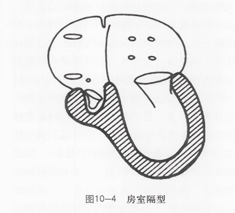 房室隔型