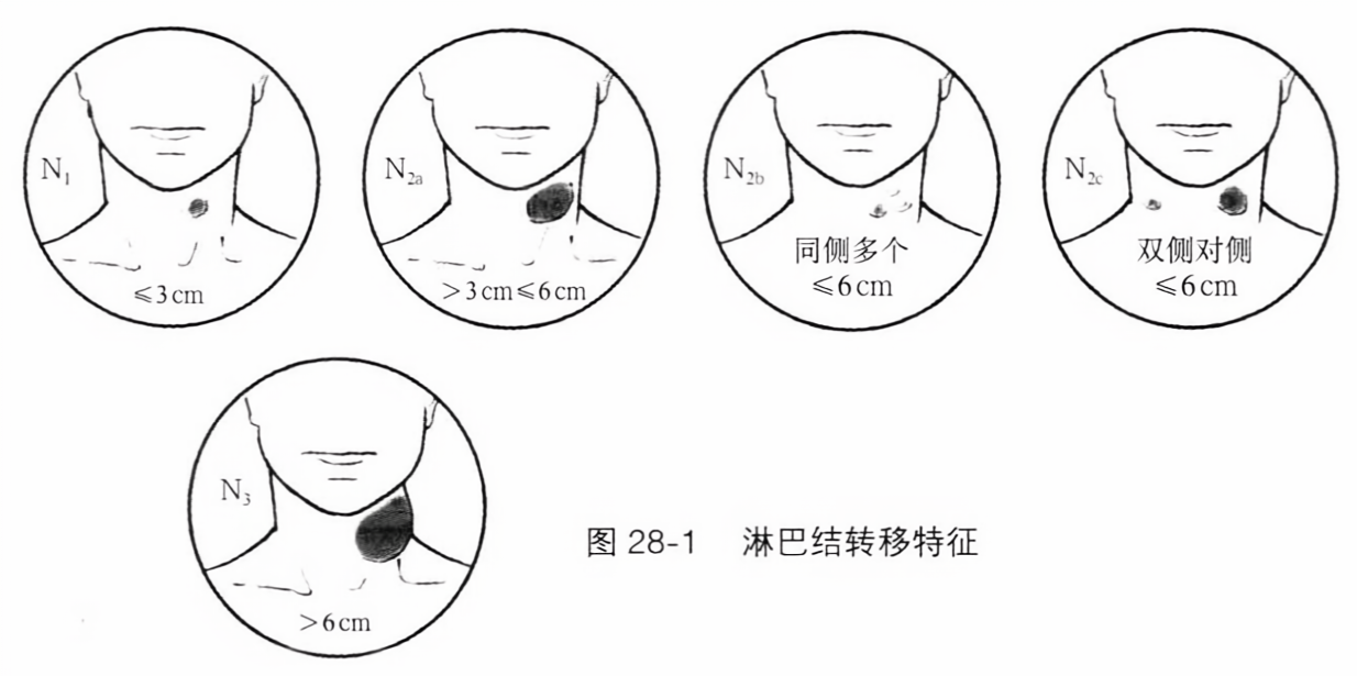 淋巴结转移特征