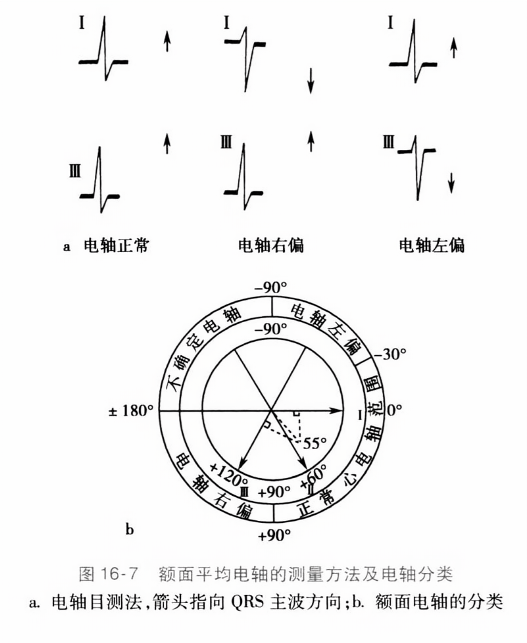 额面平均电轴的测量方法及电轴分类