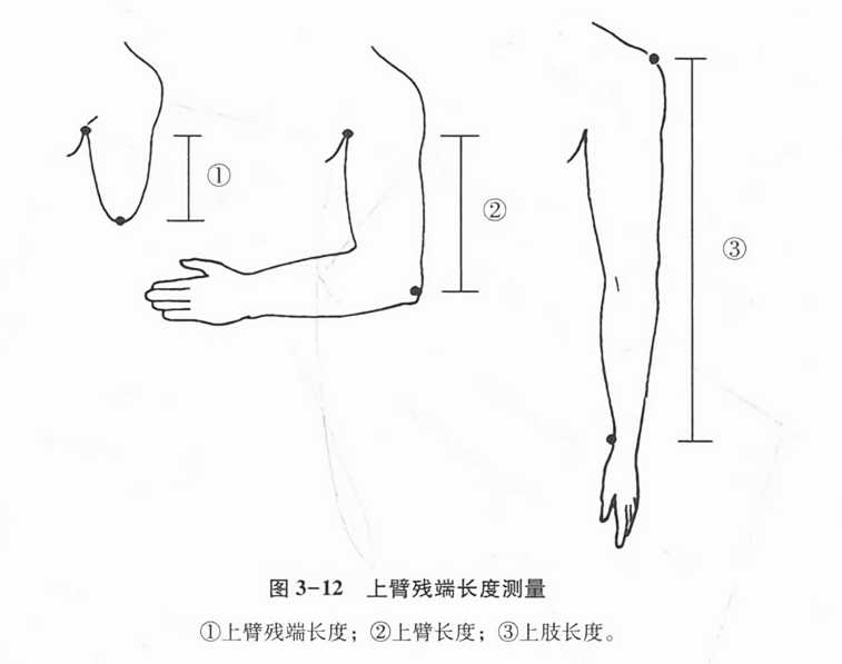 上臂残端长度测量