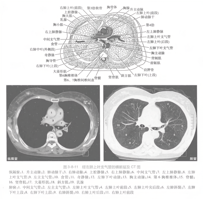 经左肺上叶支气管的横断层及 ct 图
