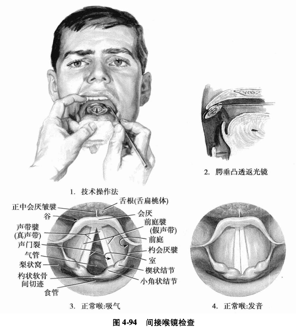 图4-94 间接喉镜检查