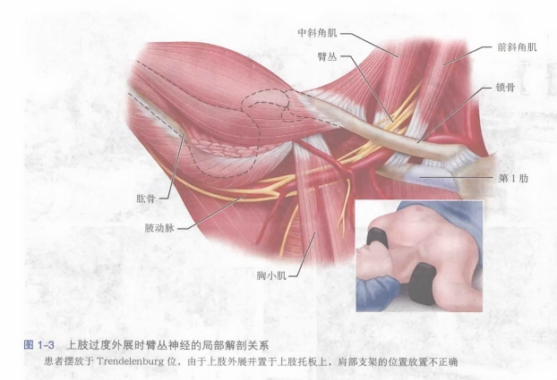 上肢过度外展时臂丛神经的局部解剖关系