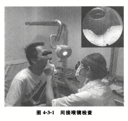 间接喉镜检查