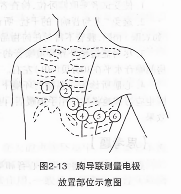 胸导联测量电极放置部位示意图