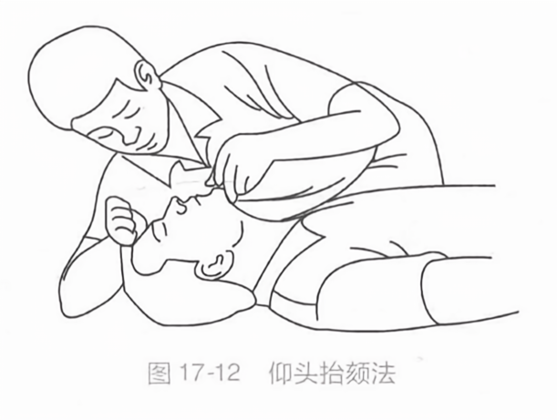 仰头抬颏法