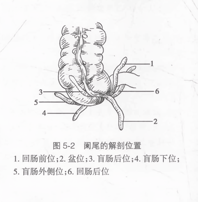 阑尾的解剖位置
