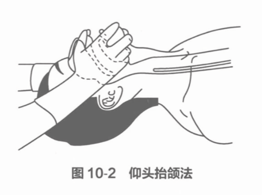 仰头抬颌法