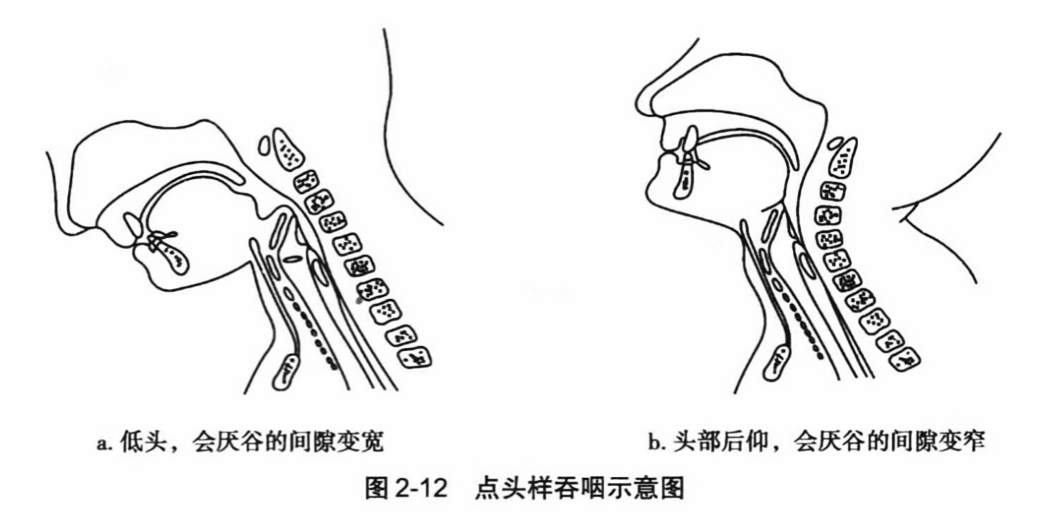 点头样吞咽示意图